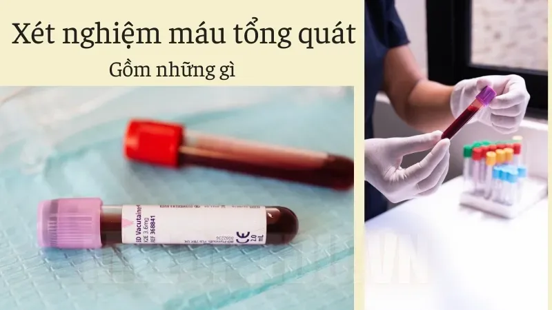 Cần làm gì trước khi xét nghiệm máu để kết quả chính xác nhất? 6